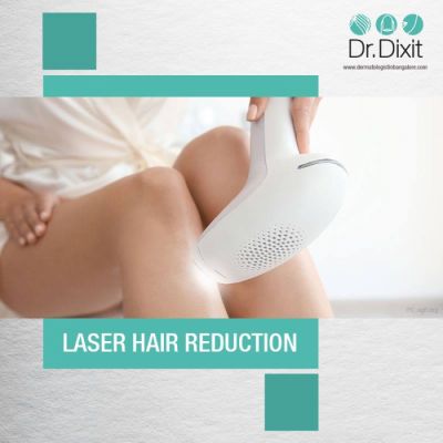 Benefits of Laser Hair Removal