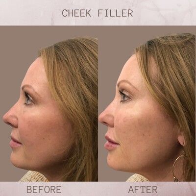 Elevate Your Aesthetic Journey: Crafting Timeless Beauty