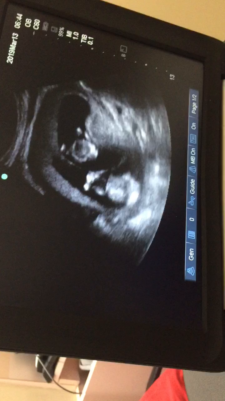 My Babies Are Twins